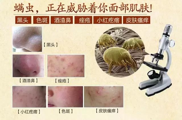 蟎蟲不除，皮膚不好，教你1招，輕鬆「滅掉」床上的蟎蟲大軍
