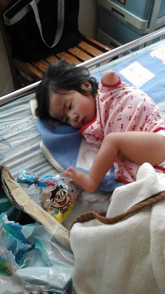 父賣米線照顧5歲身障女，她「天生只有一隻左腳」卻樂觀開朗：我的手腳不奇怪！