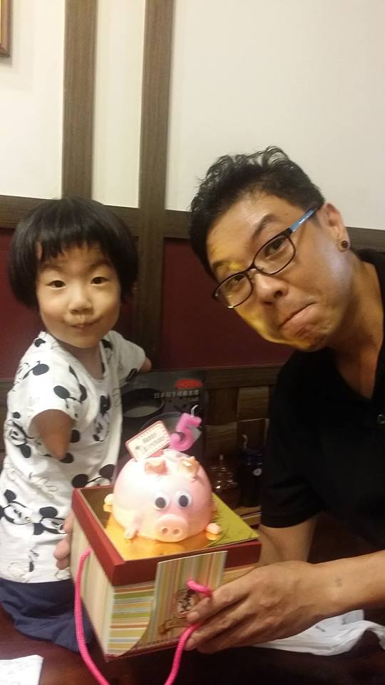 父賣米線照顧5歲身障女，她「天生只有一隻左腳」卻樂觀開朗：我的手腳不奇怪！