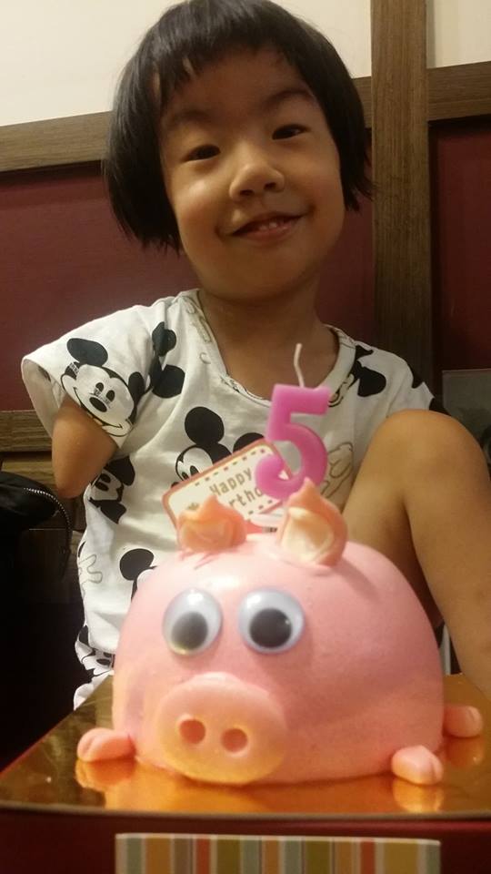 父賣米線照顧5歲身障女，她「天生只有一隻左腳」卻樂觀開朗：我的手腳不奇怪！