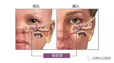 5歲男孩感冒發燒後，右耳後鼓起了紅腫的小包！這是什麼？醫生：炎症繼續發展，可能危及生命！