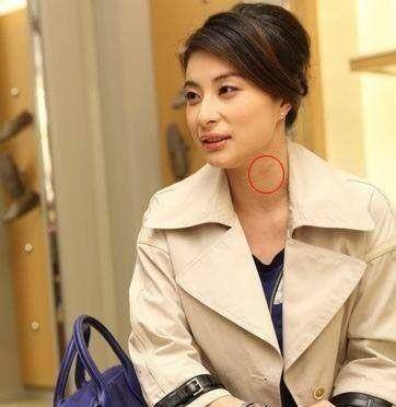 激情過度「留吻痕」的6位女星，而最後一個未婚也有？太尷尬…… -