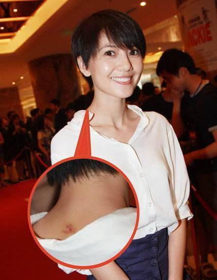 激情過度「留吻痕」的6位女星，而最後一個未婚也有？太尷尬…… -