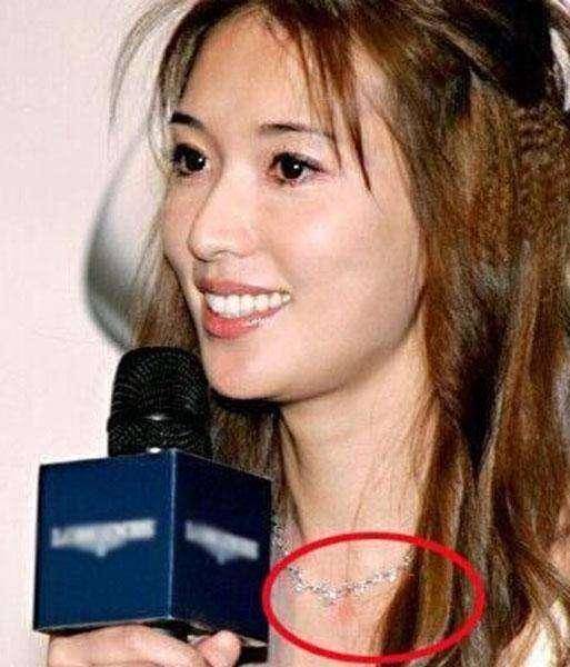 激情過度「留吻痕」的6位女星，而最後一個未婚也有？太尷尬…… -