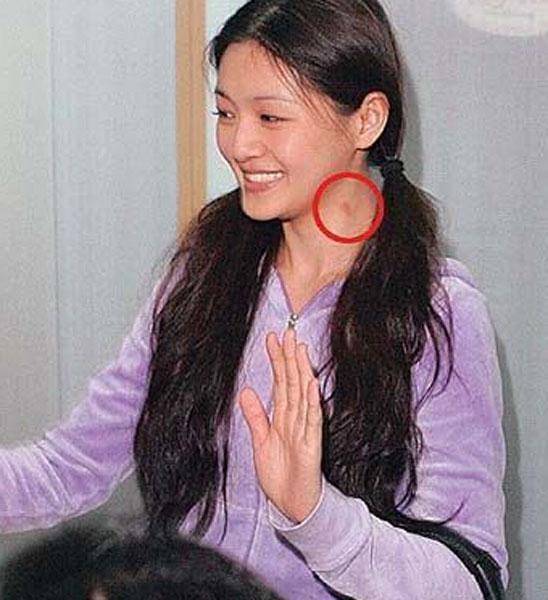激情過度「留吻痕」的6位女星，而最後一個未婚也有？太尷尬…… -