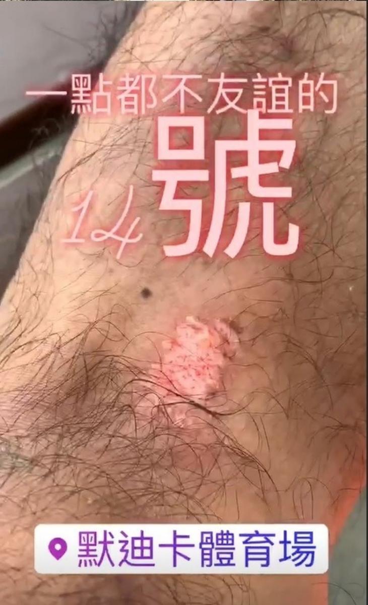 李克勤在Stadium Merdeka踢球遭大馬人弄傷, 他憤怒公開對方長相反被網民炮轟：網絡霸凌！