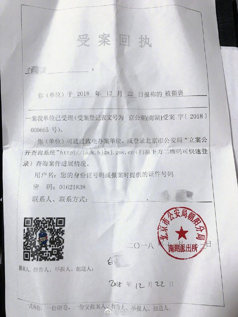 驚！BY2妹妹Yumi自爆慘遭男按摩師上下其手！伸手過程簡直是….程度！網民：被摸完了？！