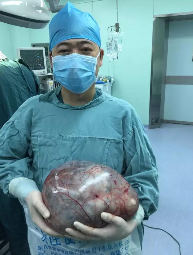 她未婚也無男友肚子卻大得出奇，到醫院檢查後醫生緊急幫她開刀，竟然在她肚子裡挖出了........太恐怖了！！ 