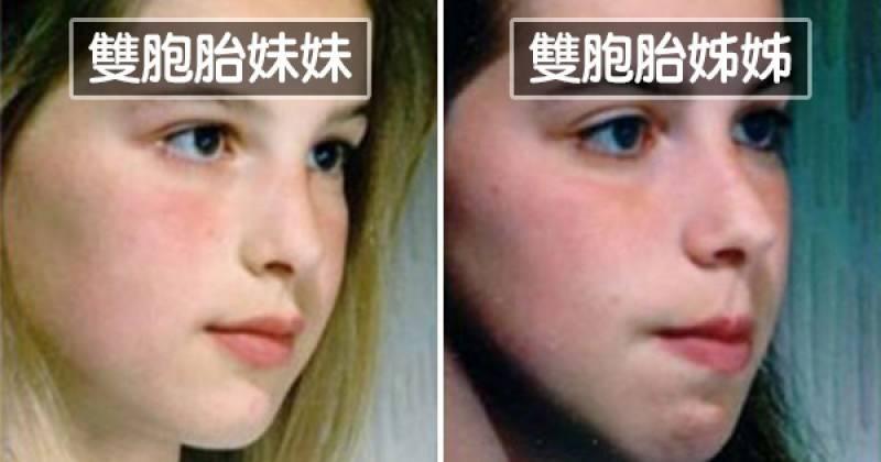 習慣嘴巴開開呼吸？醫學研究「舌頭擺放位置」決定未來顏值！