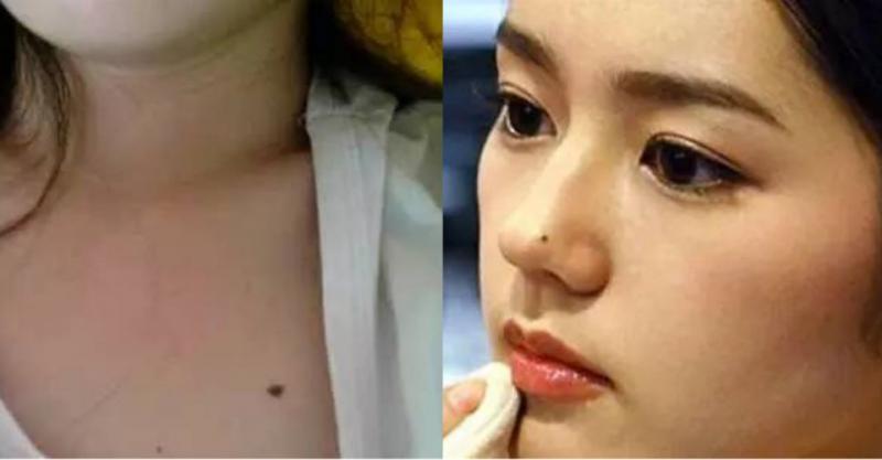 命理解析！女人不想婚姻不幸，財運不濟，一定要去掉這9顆「黴運痣」！！ 