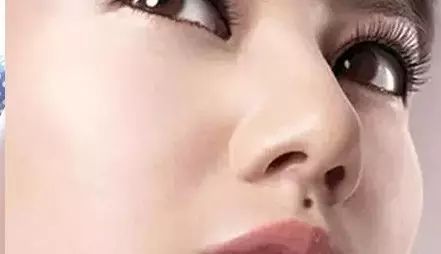 命理解析！女人不想婚姻不幸，財運不濟，一定要去掉這9顆「黴運痣」！！ 