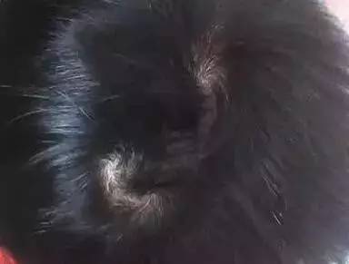 頭上有幾個漩，就代表你是什麼命！有三個漩的人註定不一般，太準了