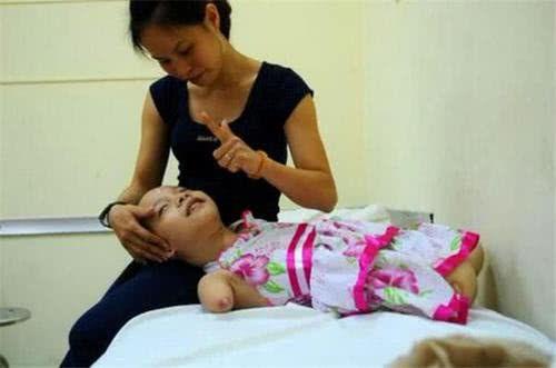 懷孕7個月查出胎兒沒有手腳，孕媽不忍放棄，用愛和責任為殘疾女兒插上翅膀