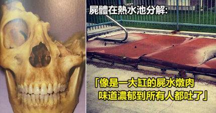 驗屍官分享心臟最大顆的人才能承受的12個超恐怖工作經驗。#9. 連環殺人魔用大石頭重砸他們的頭部
