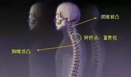 頸椎「有坨肉」，號稱「富貴包」，其實是「奪命包」！要小心！是「腦梗」的前兆！教你三招解決它！