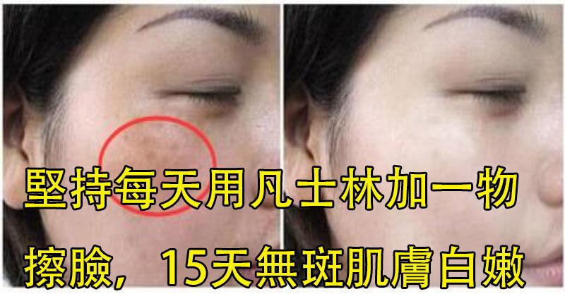 沒想到，堅持每天用「凡士林」加一物擦臉，15天還你無斑白嫩肌膚！