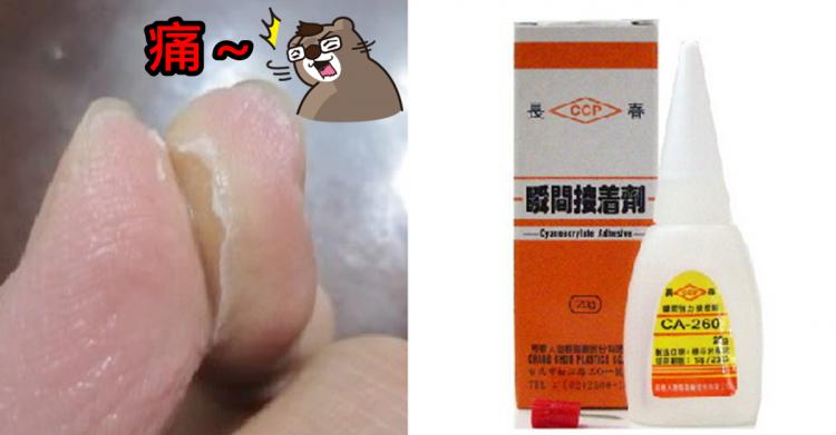 三秒膠黏到手該怎麼辦？千萬別再硬撕、刀割...「最正確方法是這樣」！無痛又不留痕跡