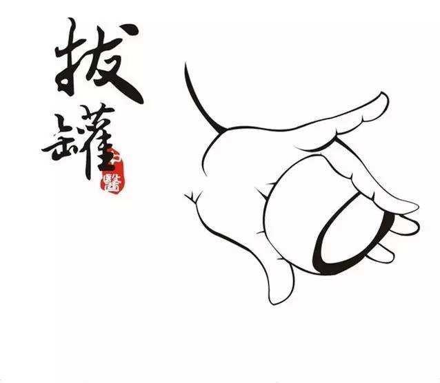 拔罐的好處那麼多還要注意哪些