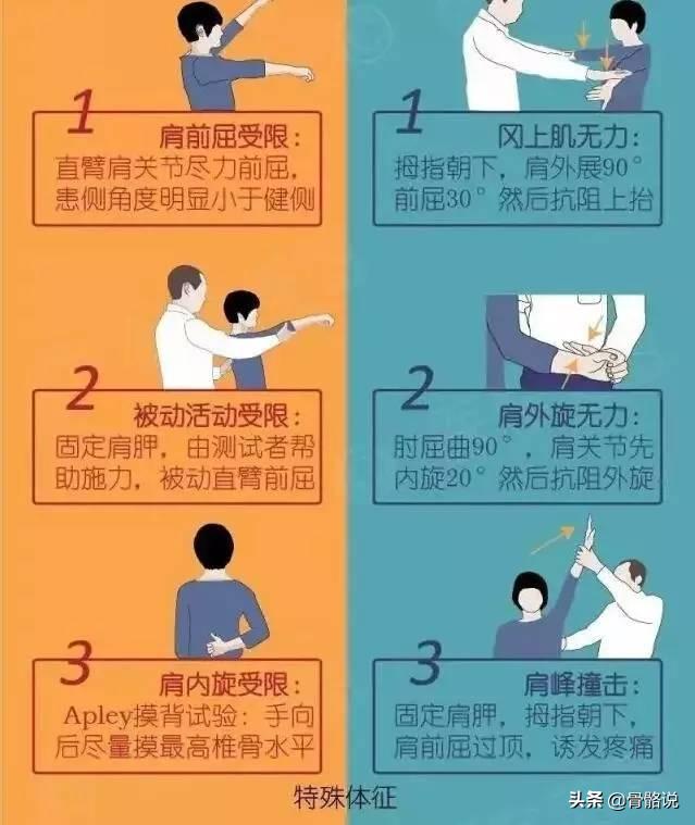 4個動作天天練，告別肩周炎不再犯