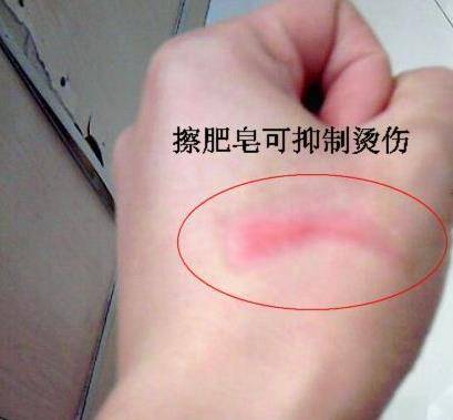 除蟑螂秘方：只用一顆馬鈴薯，就把家中蟑螂通通消滅，解決一大片，太厲害了