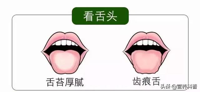 5個實用小方法，自測濕氣有多重！教你3招，健脾化濕，排出濕氣