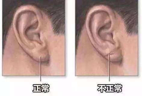 身體是否健康，看看面部就知道中醫教你30秒自測