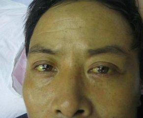 身體是否健康，看看面部就知道中醫教你30秒自測
