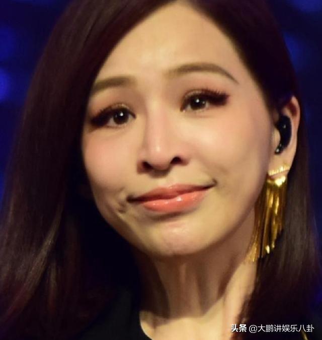 這些被「玻尿酸」毀掉的女星，看完你還敢打嗎？