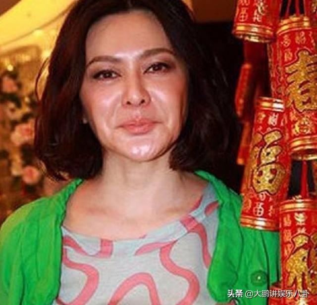 這些被「玻尿酸」毀掉的女星，看完你還敢打嗎？