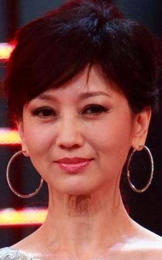 你看到的「不老神話」都是假的，女星是真老還是裝嫩？歲月饒過誰