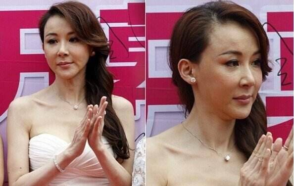 你看到的「不老神話」都是假的，女星是真老還是裝嫩？歲月饒過誰