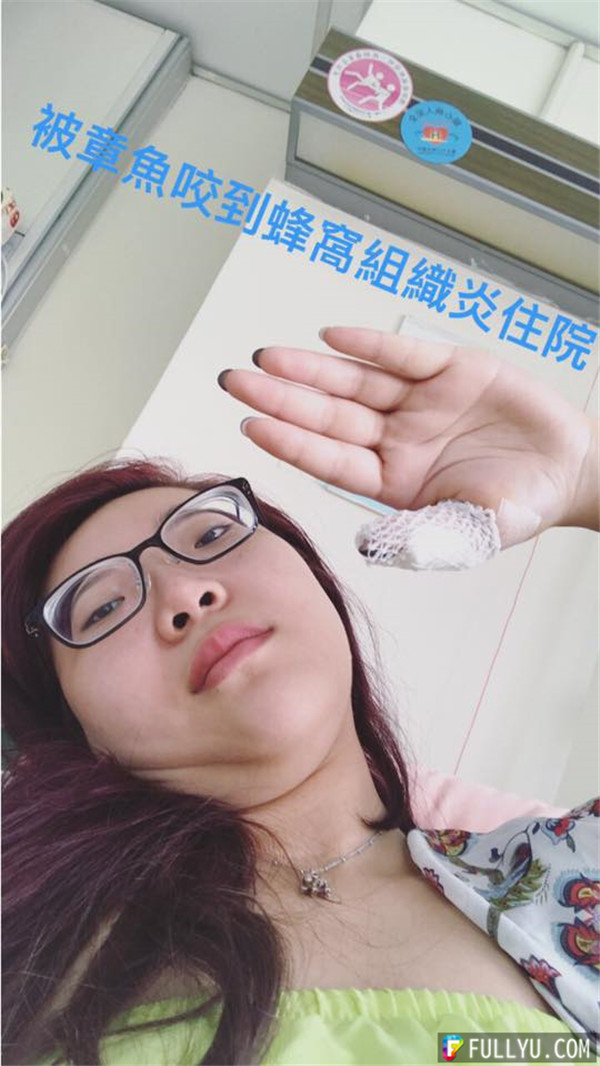 台灣網絡紅人宛宛兒竟嘗試讓章魚吸自己的...，結果章魚一吸，居然變成這樣，悲劇了！... 