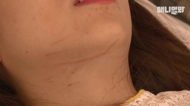 「陪睡抓傷主人」好失控！「睡著就變惡魔」醫生嘆：牠有陰影...