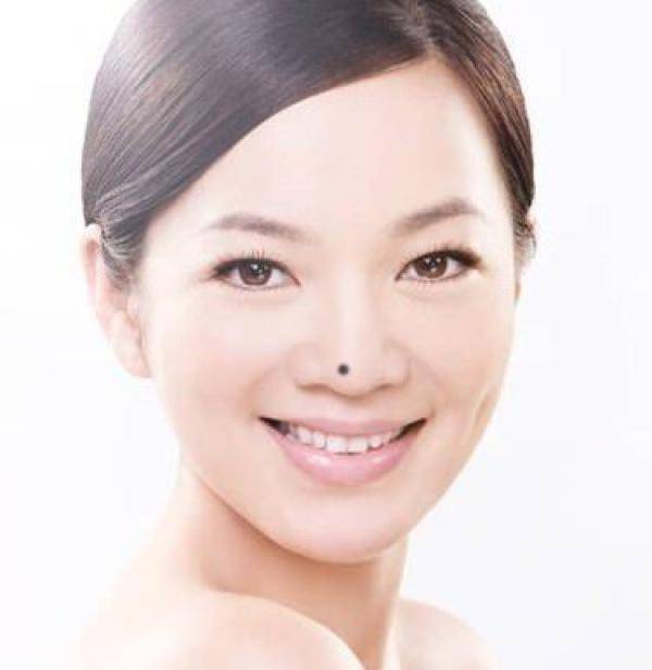 看看你身上這10處有痣嗎？只要有一個，恭喜你了，今生註定發達 