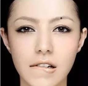 看看你身上這10處有痣嗎？只要有一個，恭喜你了，今生註定發達 