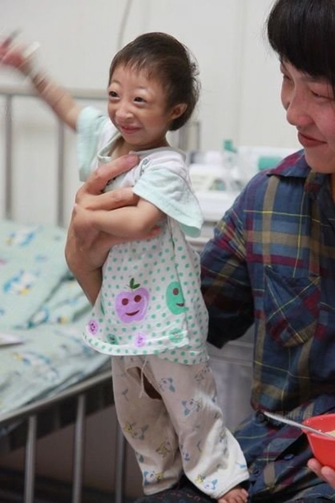 現實中的《拇指姑娘》3歲半，直擊她的日常生活，媽媽「呵護備至」不敢放鬆，網友淚崩：【最偉大的愛】
