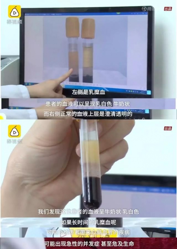23歲年輕女孩吃了「4個月的外食」竟暴瘦「40公斤」醫生警告「再吃下去，命就沒了！」