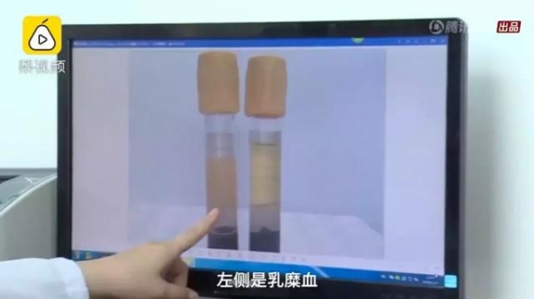 23歲年輕女孩吃了「4個月的外食」竟暴瘦「40公斤」醫生警告「再吃下去，命就沒了！」