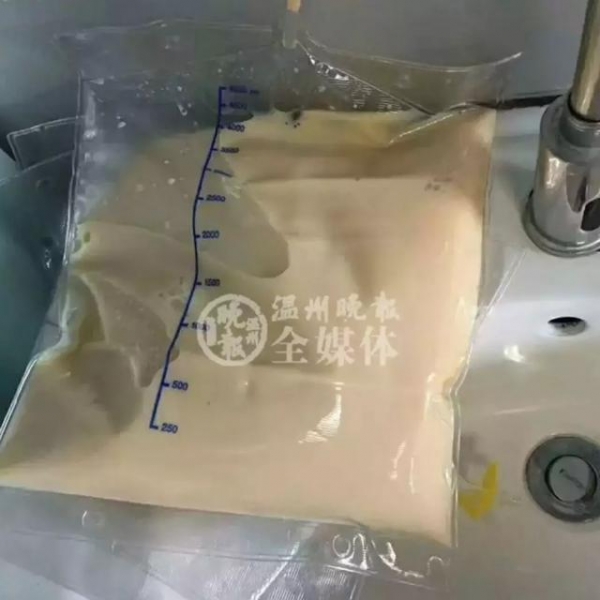 23歲年輕女孩吃了「4個月的外食」竟暴瘦「40公斤」醫生警告「再吃下去，命就沒了！」