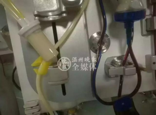 23歲年輕女孩吃了「4個月的外食」竟暴瘦「40公斤」醫生警告「再吃下去，命就沒了！」