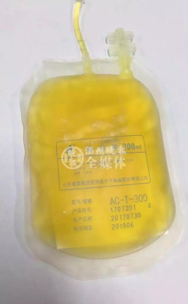 23歲年輕女孩吃了「4個月的外食」竟暴瘦「40公斤」醫生警告「再吃下去，命就沒了！」