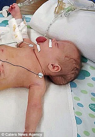 她一出生就罹患罕病「舌頭比嘴巴大兩倍」差點被舌頭噎死，「從中間割開」首度露出笑容萌到你會跟著笑！