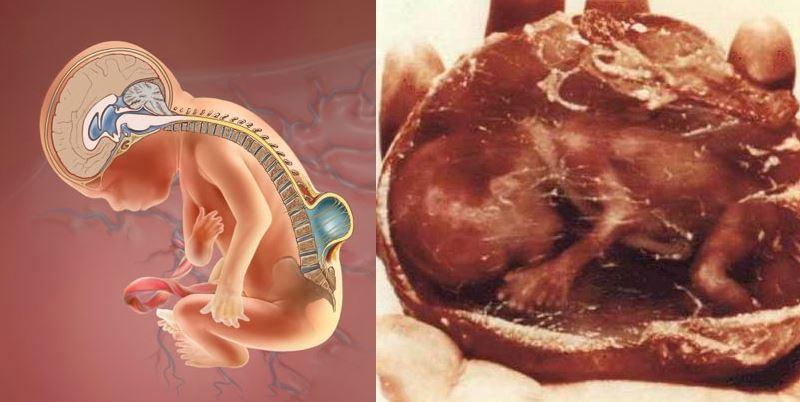 妳知道墮胎後嬰靈究竟去哪裡了嗎？（看完真的很難過…轉發給更多人知道！）