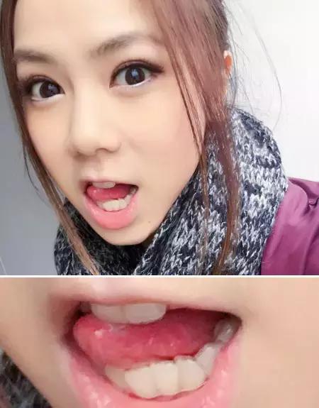 那些默默變美的明星們不是整容，原來全靠這一招！