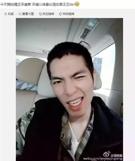 那些默默變美的明星們不是整容，原來全靠這一招！
