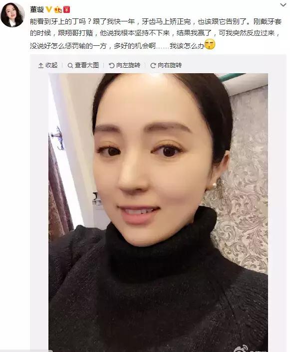 那些默默變美的明星們不是整容，原來全靠這一招！