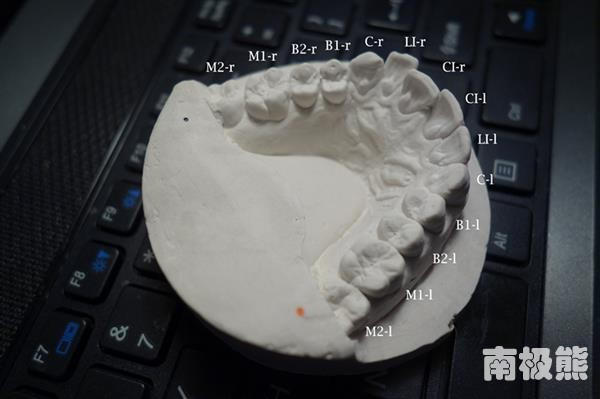 他自己做「牙套」只花了不到2000元，結果讓人贊賞...「這招」外流的話牙醫診所都要哭了！