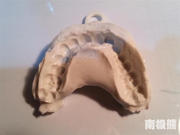 他自己做「牙套」只花了不到2000元，結果讓人贊賞...「這招」外流的話牙醫診所都要哭了！