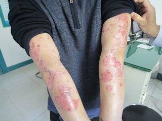 過了40歲，體內這9種毒，不除很難長壽！排出陰毒，健康少病，延年益壽！