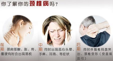 我的心慌原來是頸椎病造成的交感神經型頸椎病